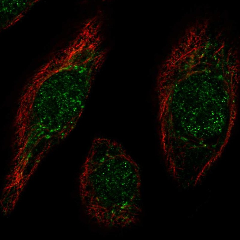 Immunofluorescent staining of human cell line hTCEpi shows localization to nucleus & the Golgi apparatus. Immunofluorescent staining of human cell line hTCEpi shows localization to nucleus & the Golgi apparatus.