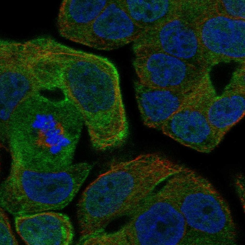 Immunofluorescent staining of human cell line OE19 shows localization to plasma membrane.