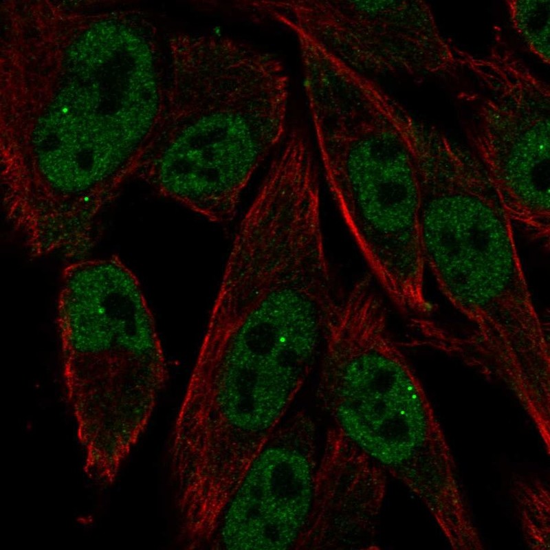 Immunofluorescent staining of human cell line SK-MEL-30 shows localization to nucleoplasm & nuclear bodies.