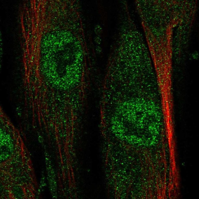 Immunofluorescent staining of human cell line ASC TERT1 shows localization to nucleoplasm.
