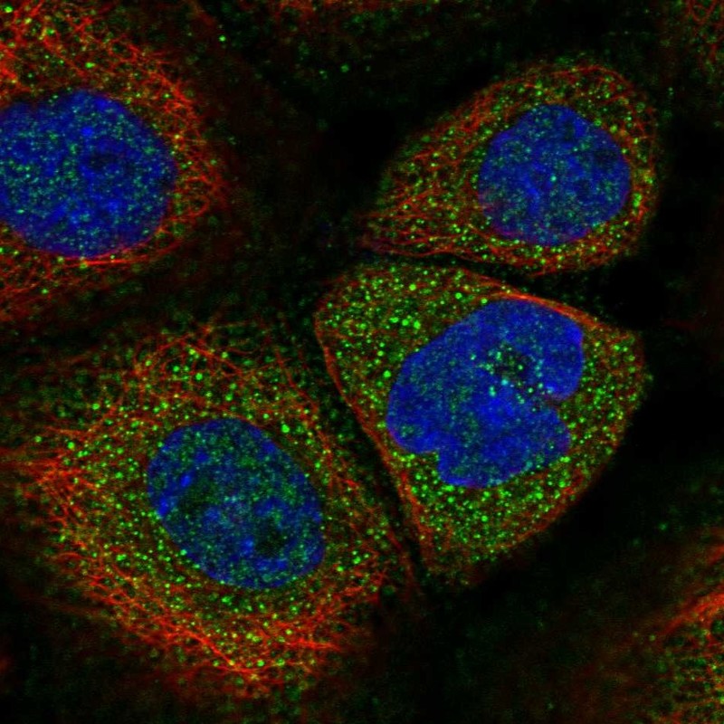 Immunofluorescent staining of human cell line A-431 shows localization to plasma membrane & cytosol.