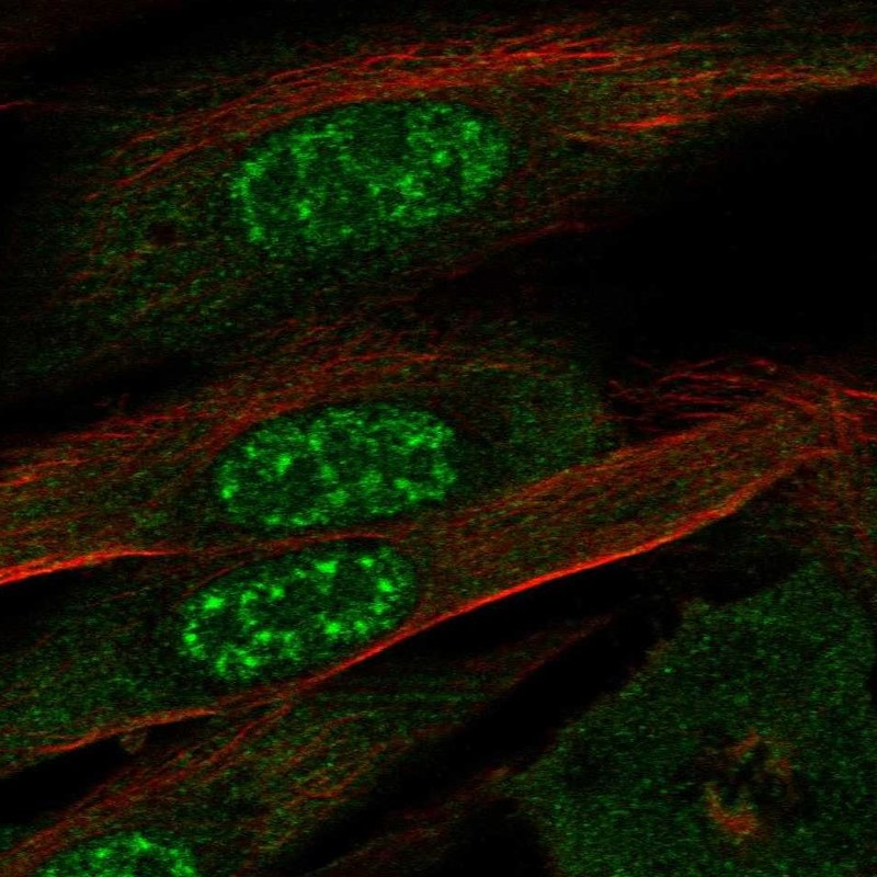 Immunofluorescent staining of human cell line ASC TERT1 shows localization to nuclear speckles & cytosol. Immunofluorescent staining of human cell line ASC TERT1 shows localization to nuclear speckles & cytosol.