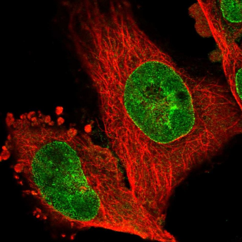 Immunofluorescent staining of human cell line U-251 MG shows localization to nucleoplasm & nuclear membrane. Immunofluorescent staining of human cell line U-251 MG shows localization to nucleoplasm & nuclear membrane.