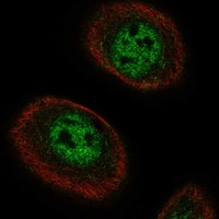 Immunofluorescent staining of human cell line hTCEpi shows localization to nucleoplasm.