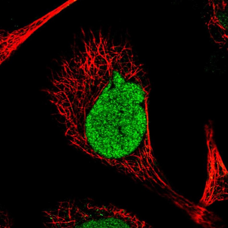 Immunofluorescent staining of human cell line A-431 shows localization to nucleus. Immunofluorescent staining of human cell line A-431 shows localization to nucleus.