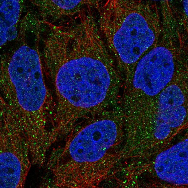 Immunofluorescent staining of human cell line CACO-2 shows localization to vesicles. Immunofluorescent staining of human cell line CACO-2 shows localization to vesicles.