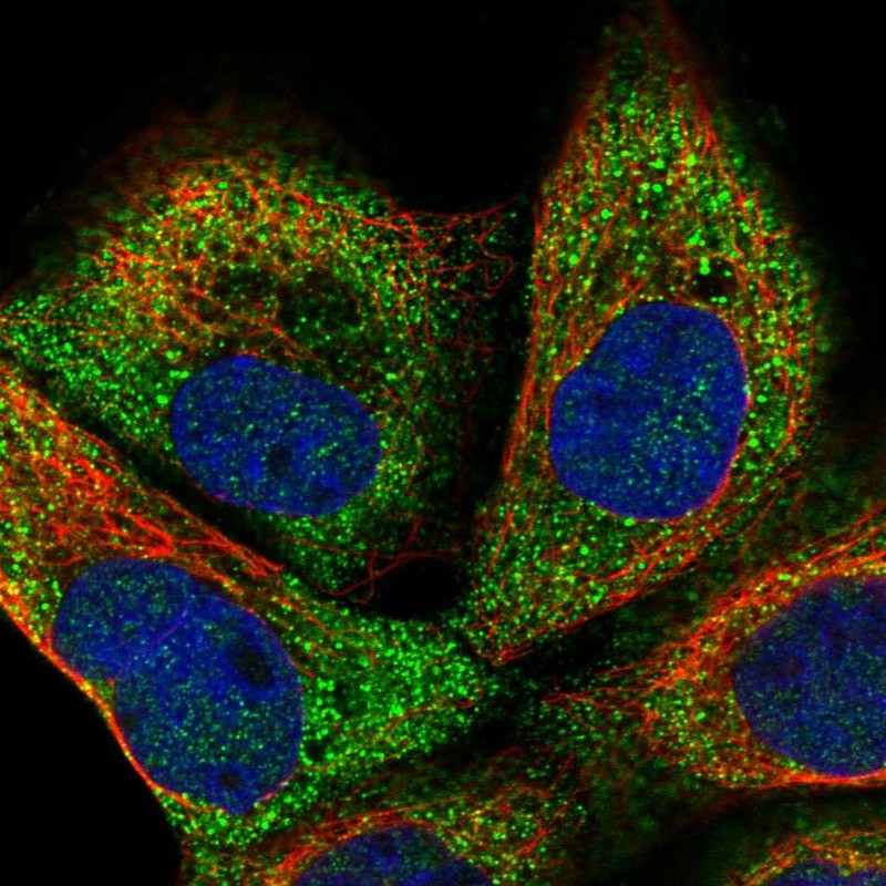 Immunofluorescent staining of human cell line A-431 shows localization to cytosol.