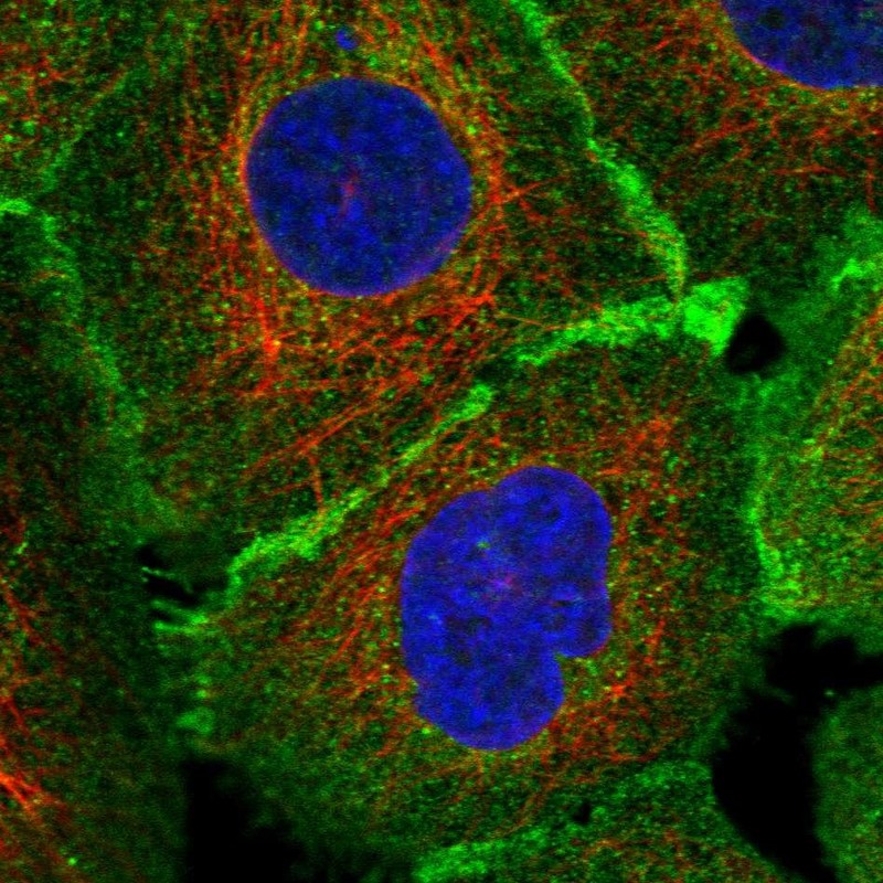 Immunofluorescent staining of human cell line A-431 shows localization to plasma membrane & cell junctions. Immunofluorescent staining of human cell line A-431 shows localization to plasma membrane & cell junctions.