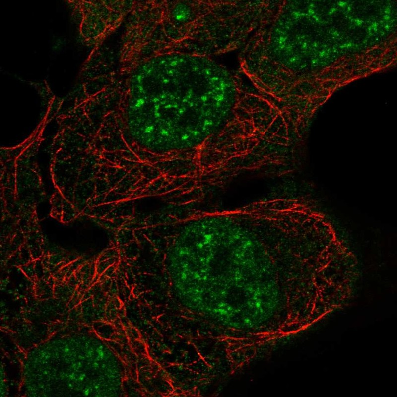 Immunofluorescent staining of human cell line RT4 shows localization to nuclear speckles & cytosol.