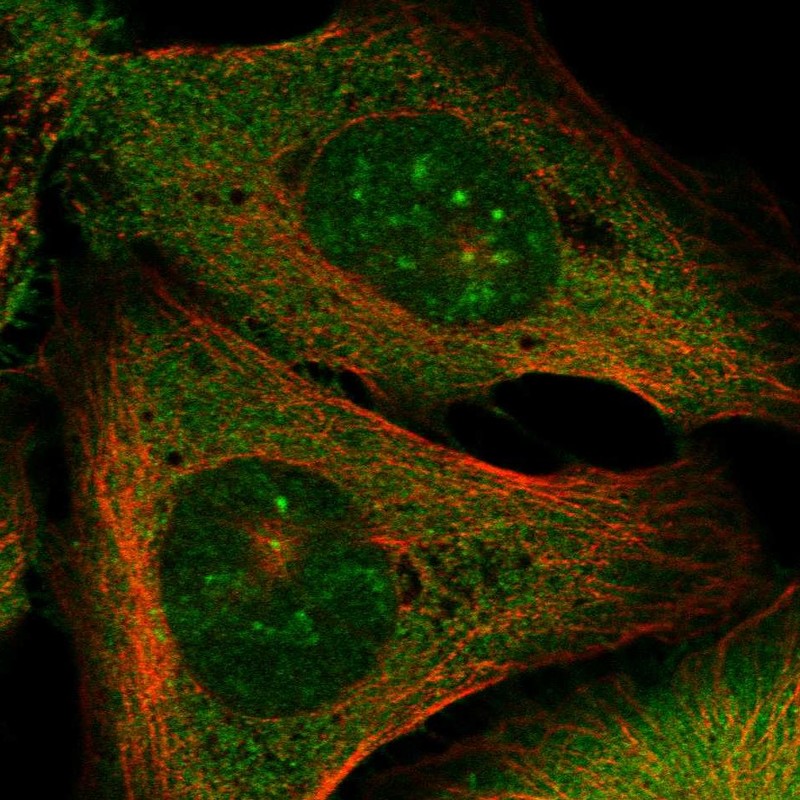 Immunofluorescent staining of human cell line U-2 OS shows localization to nucleoli, plasma membrane & centrosome. Immunofluorescent staining of human cell line U-2 OS shows localization to nucleoli, plasma membrane & centrosome.