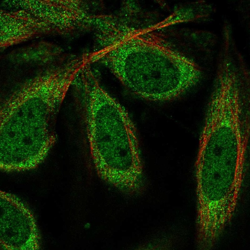 Immunofluorescent staining of human cell line SiHa shows localization to nucleoplasm & cytosol.