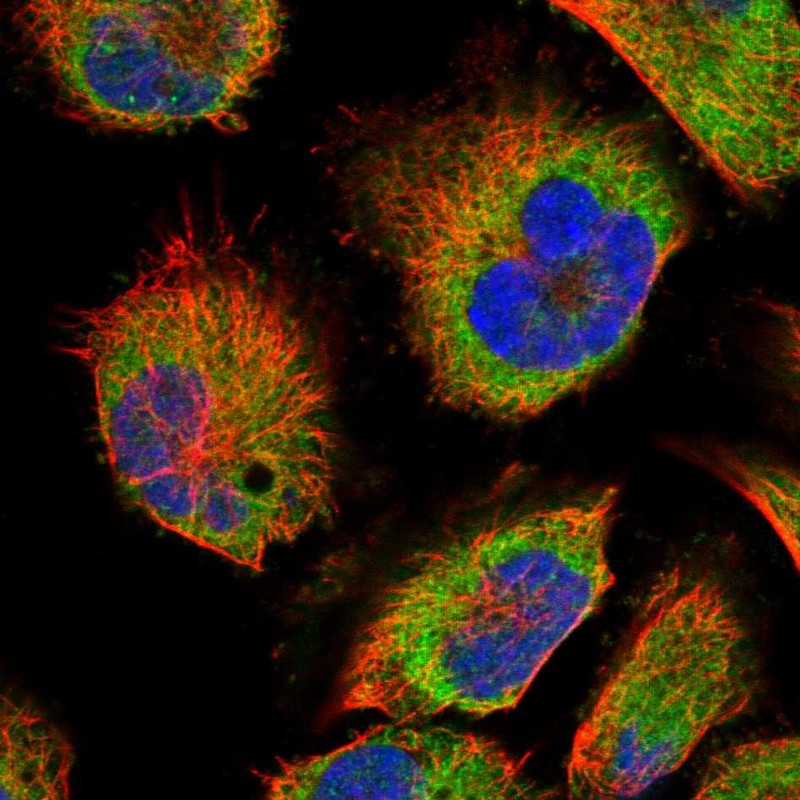 Immunofluorescent staining of human cell line U-251 MG shows localization to endoplasmic reticulum. Immunofluorescent staining of human cell line U-251 MG shows localization to endoplasmic reticulum.