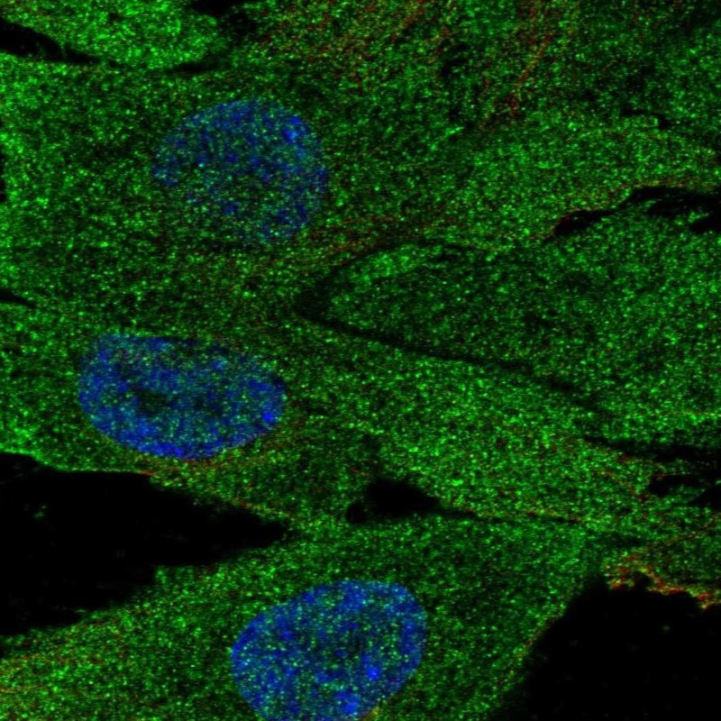 Immunofluorescent staining of human cell line ASC TERT1 shows localization to plasma membrane.