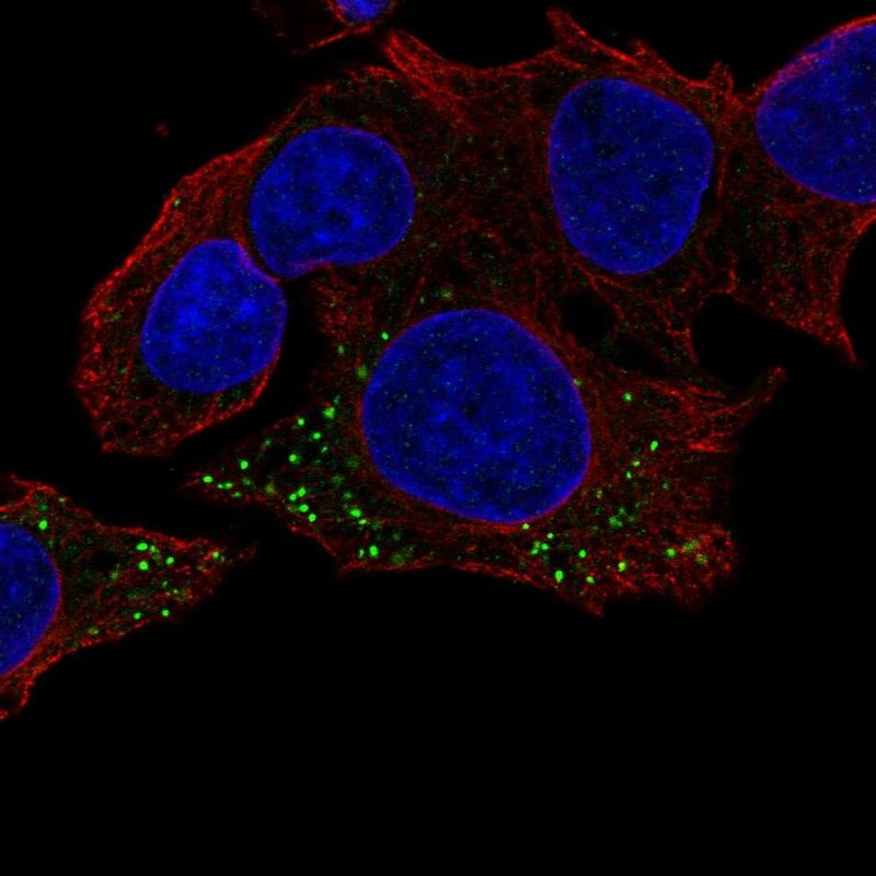 Immunofluorescent staining of human cell line Hep G2 shows localization to vesicles. Immunofluorescent staining of human cell line Hep G2 shows localization to vesicles.