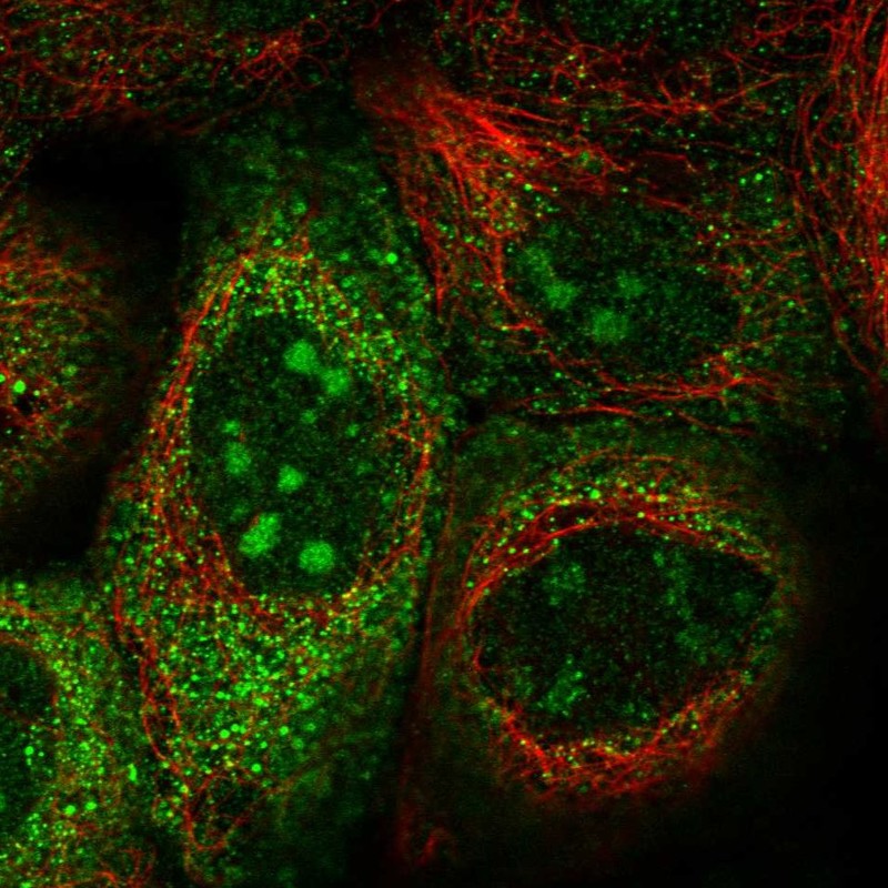 Immunofluorescent staining of human cell line A-431 shows localization to nucleoli & cytosol.