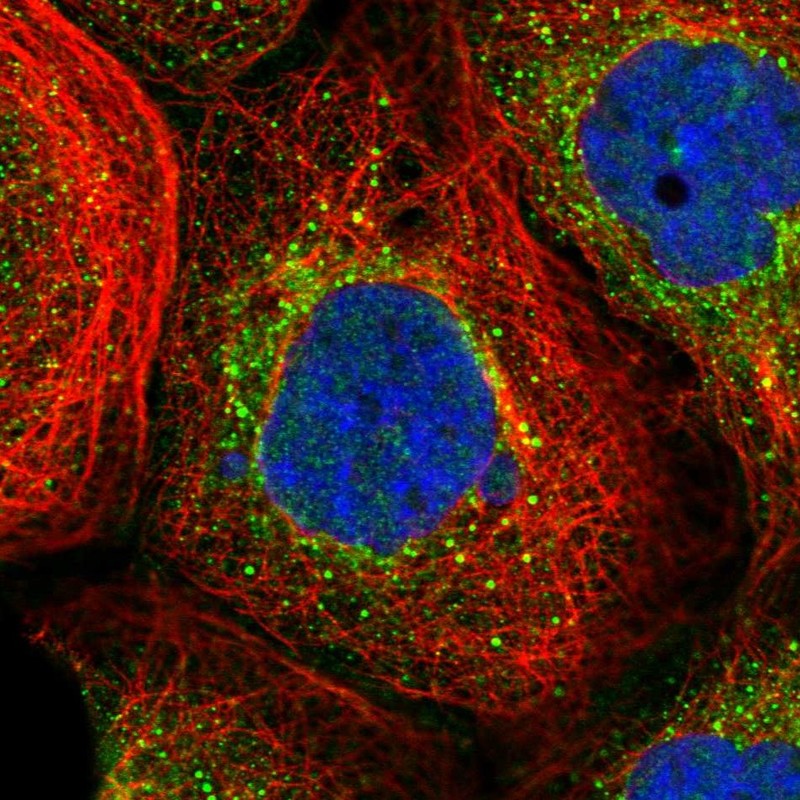 Immunofluorescent staining of human cell line A-431 shows localization to vesicles.