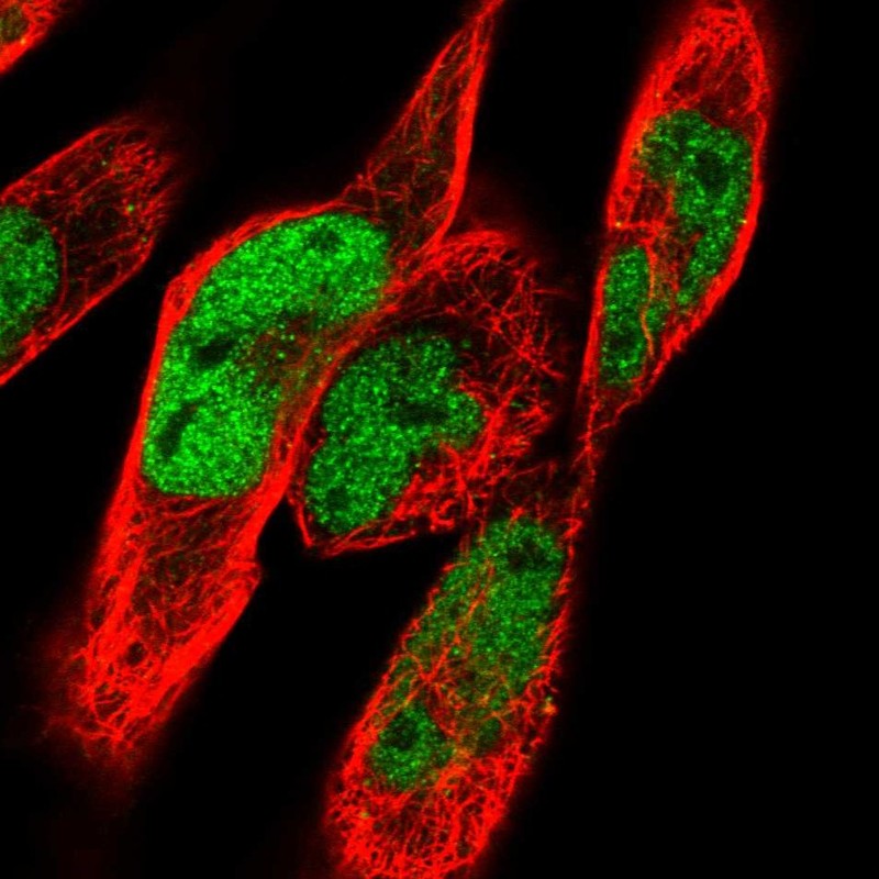 Immunofluorescent staining of human cell line RH-30 shows localization to nucleoplasm.