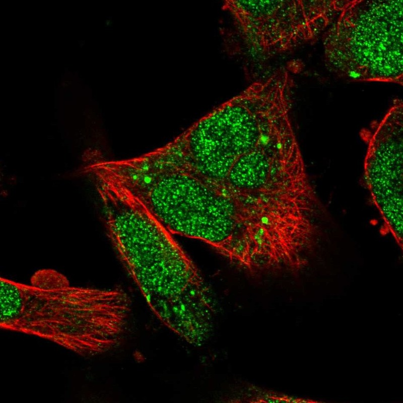 Immunofluorescent staining of human cell line U-251 MG shows localization to nucleus, cytosol & vesicles.