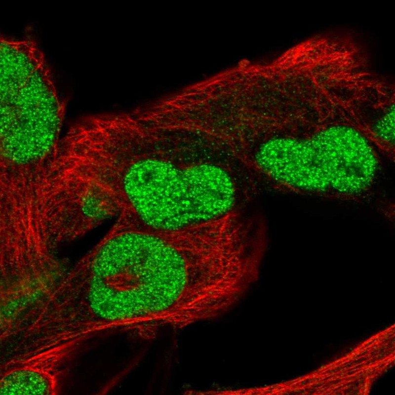Immunofluorescent staining of human cell line RH-30 shows localization to nucleus.