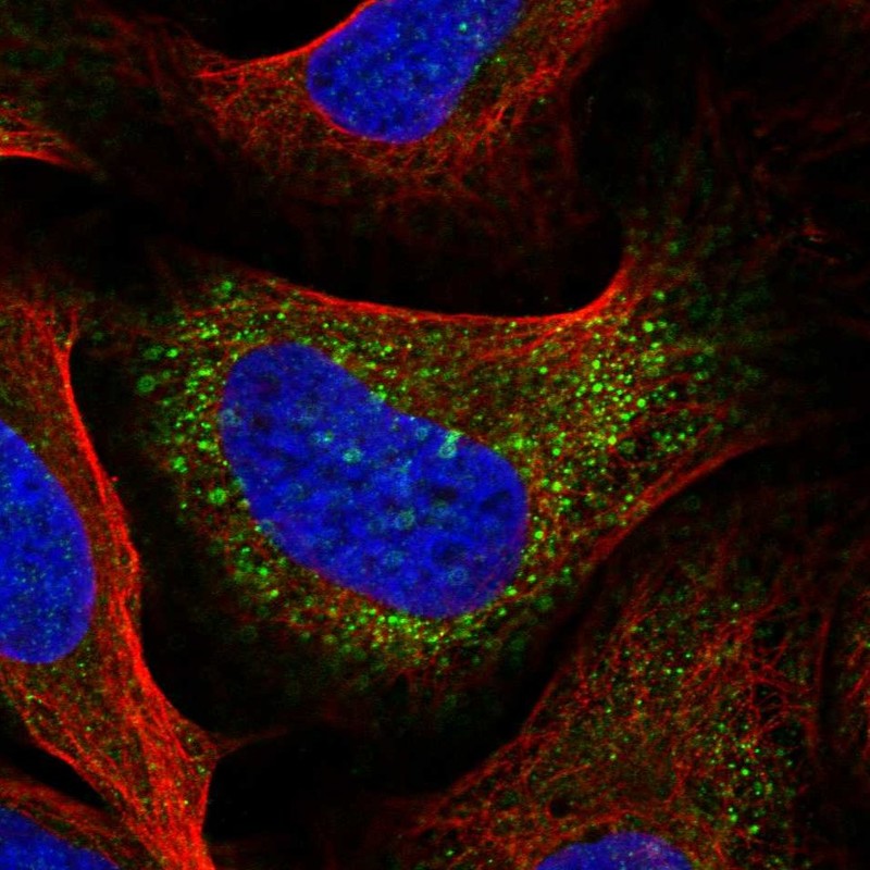 Immunofluorescent staining of human cell line U-2 OS shows localization to vesicles.