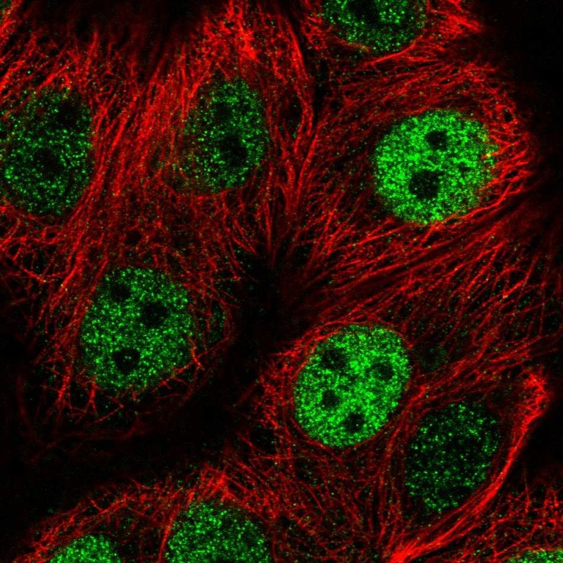 Immunofluorescent staining of human cell line MCF7 shows localization to nucleoplasm.
