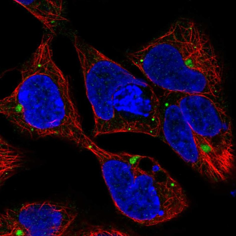 Immunofluorescent staining of human cell line HEK 293 shows localization to aggresome & vesicles.