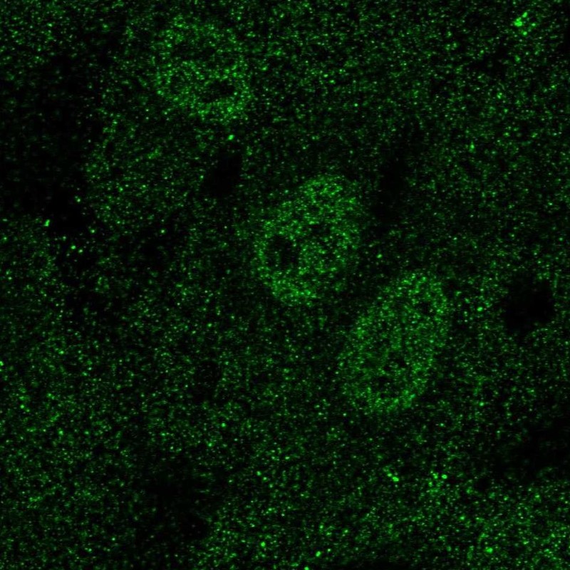 Immunofluorescent staining of human cell line HUVEC TERT2 shows localization to nucleoplasm.