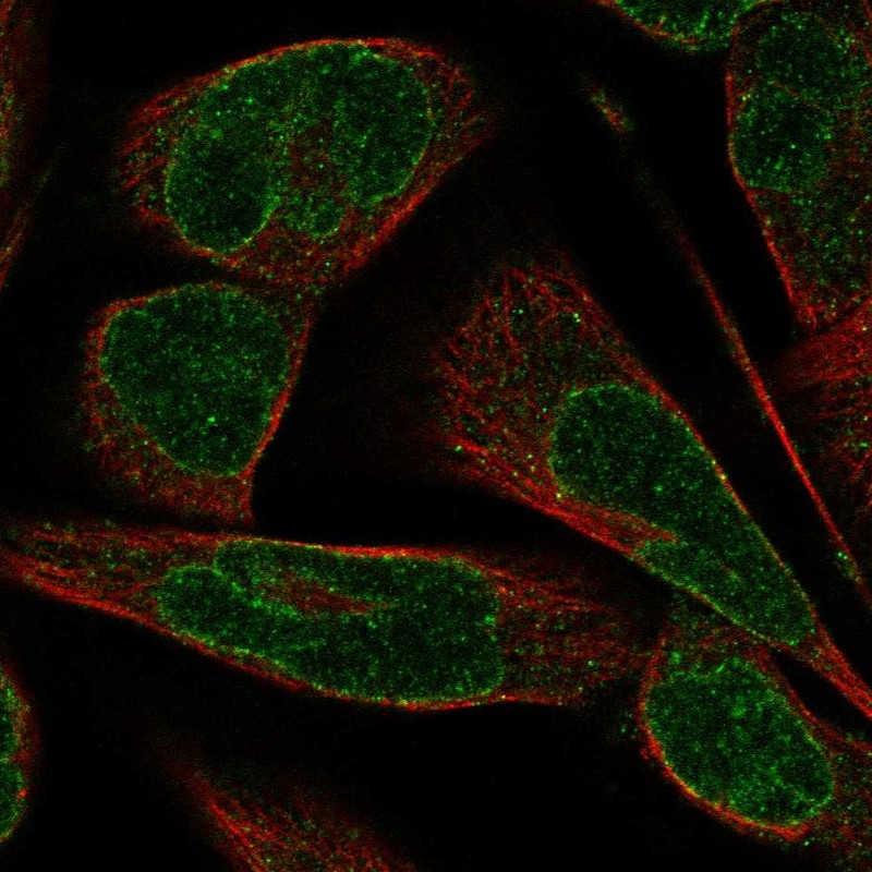 Immunofluorescent staining of human cell line RH-30 shows localization to nuclear membrane.