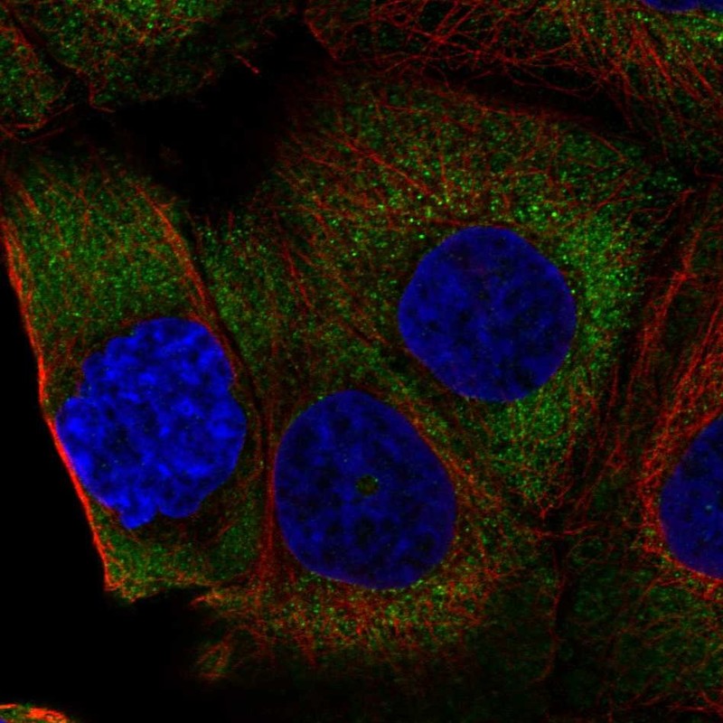 Immunofluorescent staining of human cell line A-431 shows localization to cytosol & endoplasmic reticulum.