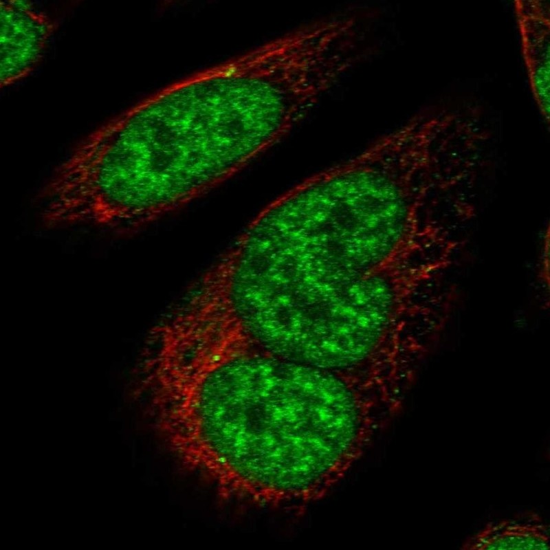 Immunofluorescent staining of human cell line SiHa shows localization to nucleoplasm & nuclear speckles.