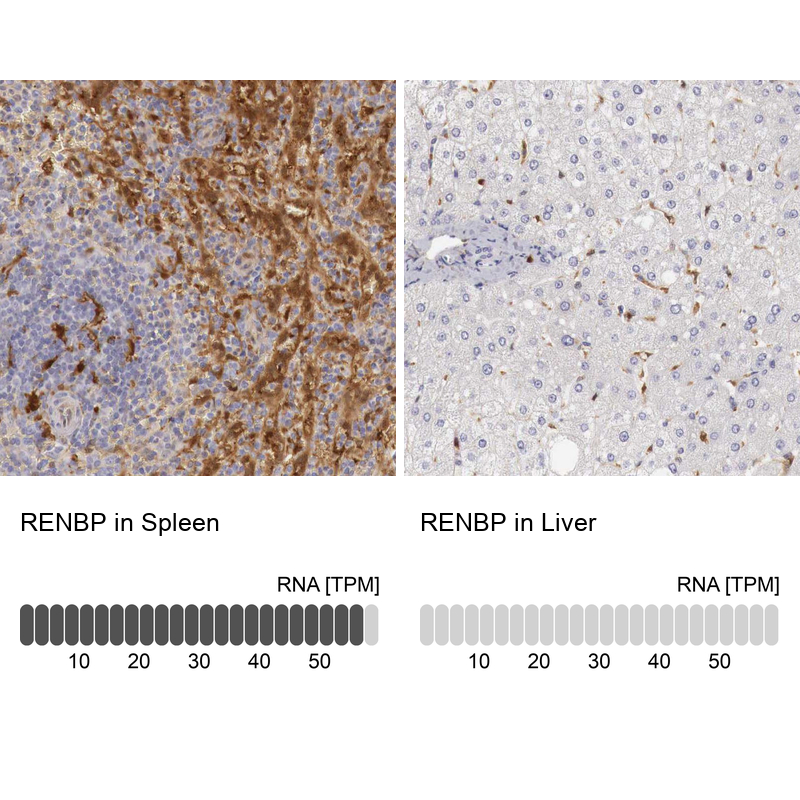 Immunohistochemistry analysis in human spleen and liver tissues using Anti-RENBP antibody. Corresponding RENBP RNA-seq data are presented for the same tissues.