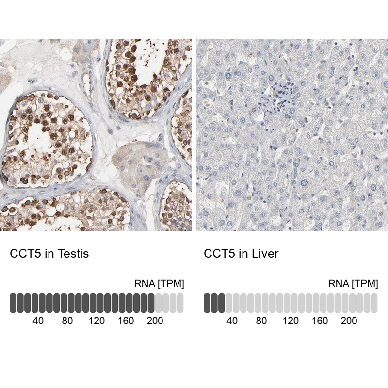 Immunohistochemistry analysis in human testis and liver tissues using Anti-CCT5 antibody. Corresponding CCT5 RNA-seq data are presented for the same tissues.