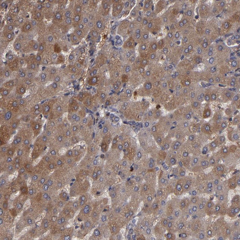 Immunohistochemical staining of human liver shows cytoplasmic positivity in hepatocytes.