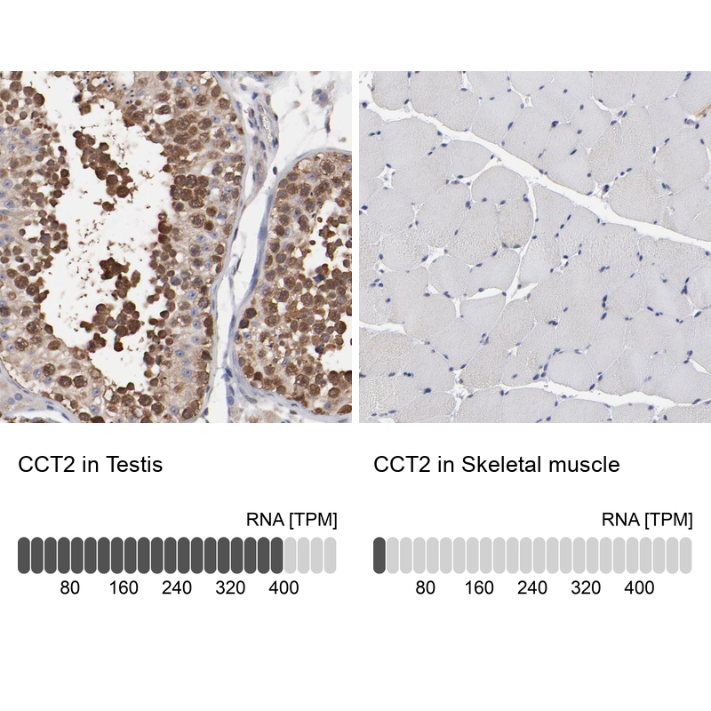 Immunohistochemistry analysis in human testis and skeletal muscle tissues using Anti-CCT2 antibody. Corresponding CCT2 RNA-seq data are presented for the same tissues.