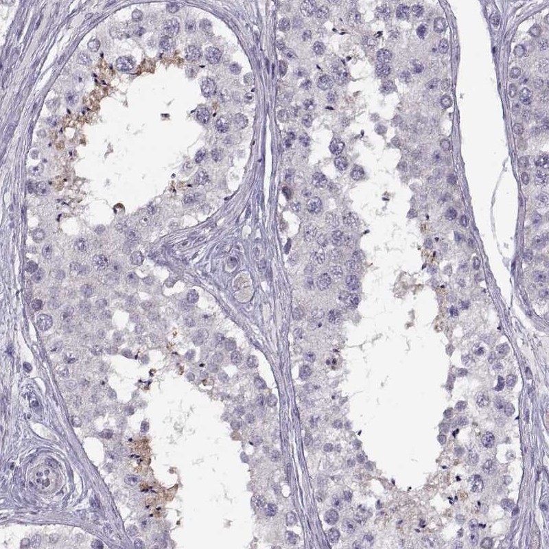 Immunohistochemical staining of human testis shows moderate cytoplasmic positivity in sperms.