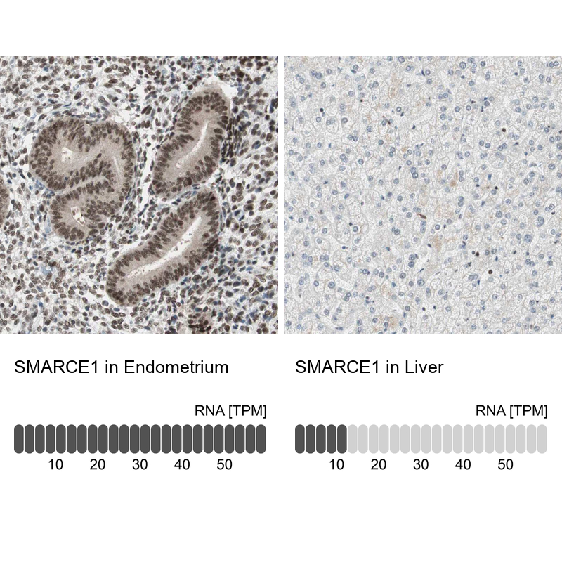 Immunohistochemistry analysis in human endometrium and liver tissues using Anti-SMARCE1 antibody. Corresponding SMARCE1 RNA-seq data are presented for the same tissues.
