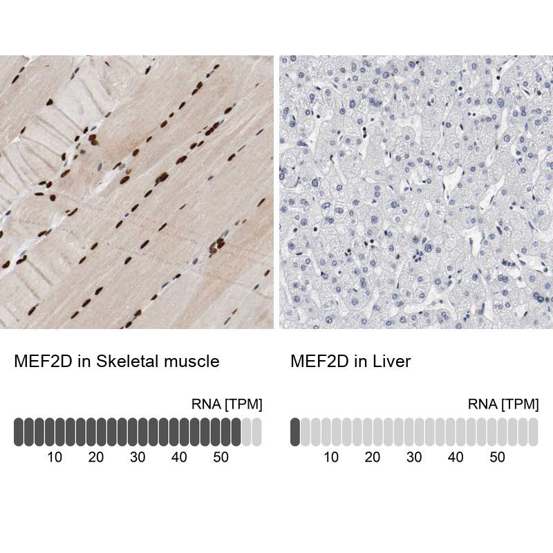 Immunohistochemistry analysis in human skeletal muscle and liver tissues using HPA004807 antibody. Corresponding MEF2D RNA-seq data are presented for the same tissues.