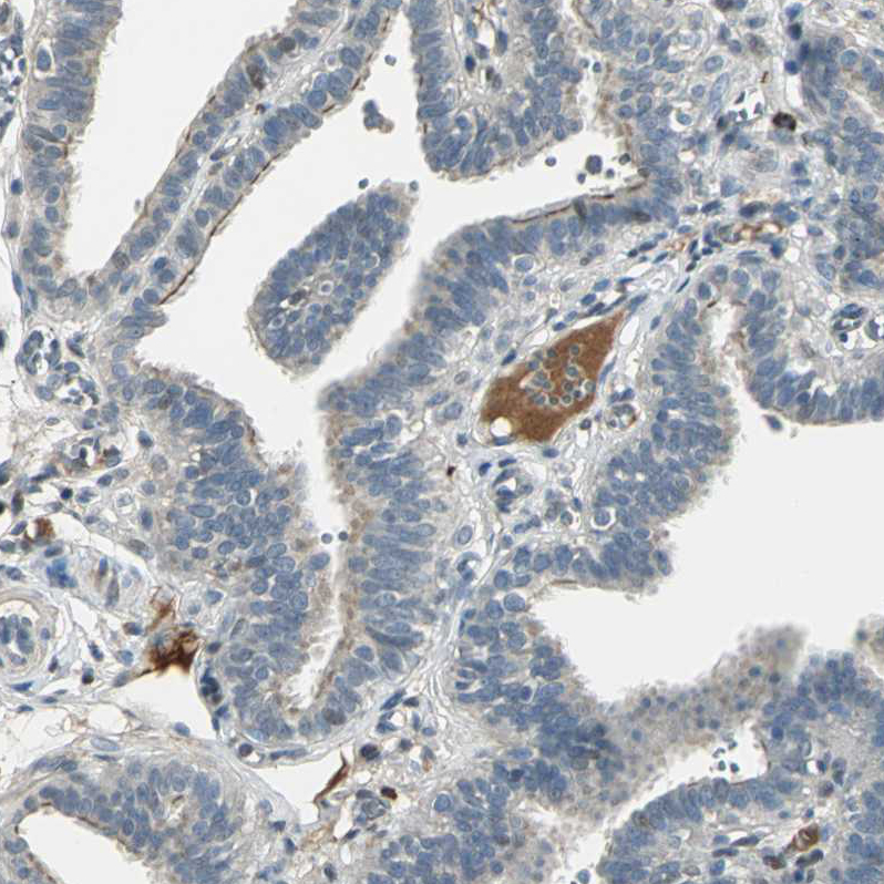 Immunohistochemical staining of human fallopian tube shows moderate positivity in plasma in blood vessels.