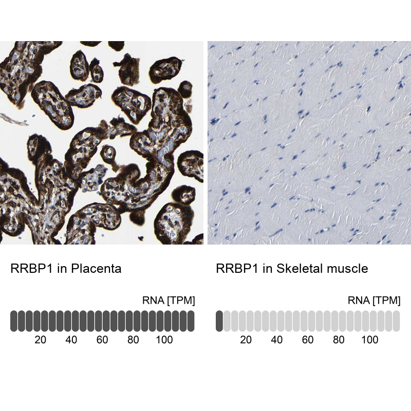 Immunohistochemistry analysis in human placenta and skeletal muscle tissues using Anti-RRBP1 antibody. Corresponding RRBP1 RNA-seq data are presented for the same tissues.