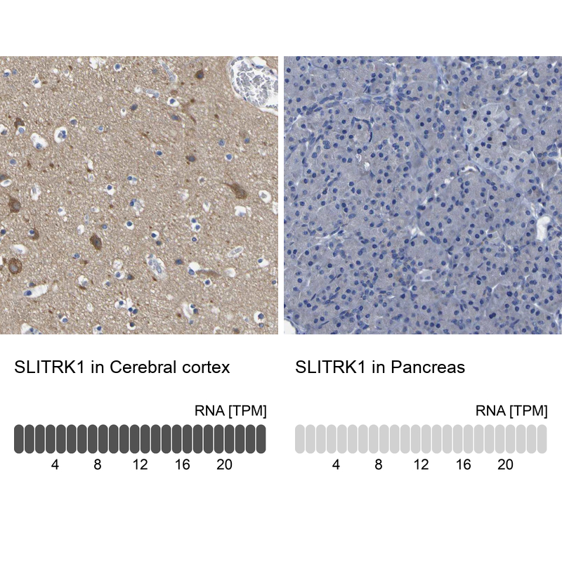 Immunohistochemistry analysis in human cerebral cortex and pancreas tissues using Anti-SLITRK1 antibody. Corresponding SLITRK1 RNA-seq data are presented for the same tissues.