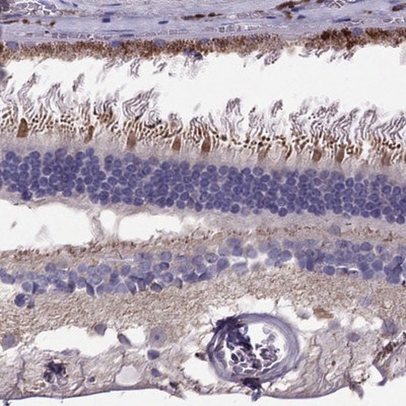 Immunohistochemical staining of human retina shows strong cytoplasmic positivity in photoreceptor segments