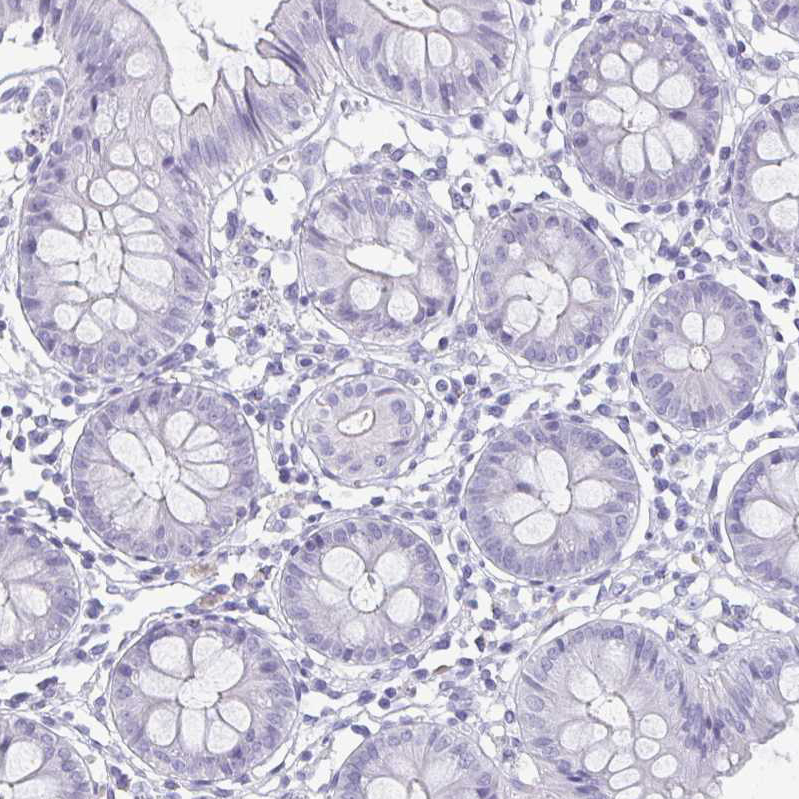 Immunohistochemical staining of human colon shows no positivity in glandular cells as expected.
