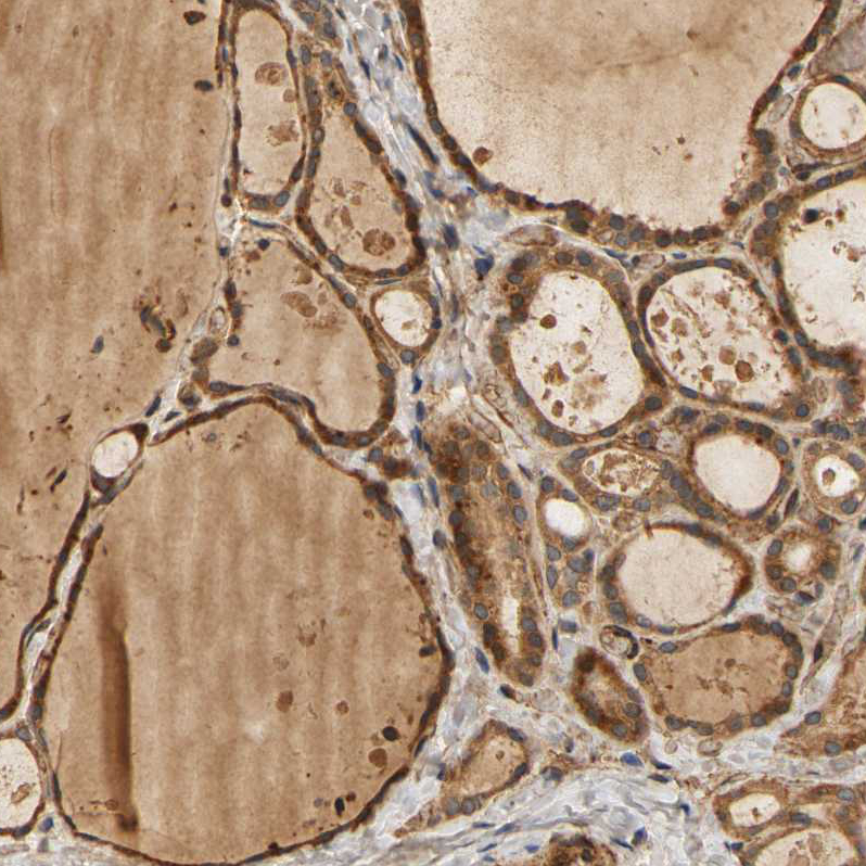Immunohistochemical staining of human thyroid gland shows strong cytoplasmic positivity in glandular cells.