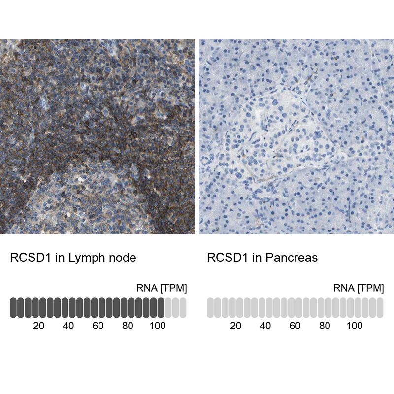 Immunohistochemistry analysis in human lymph node and pancreas tissues using Anti-RCSD1 antibody. Corresponding RCSD1 RNA-seq data are presented for the same tissues.