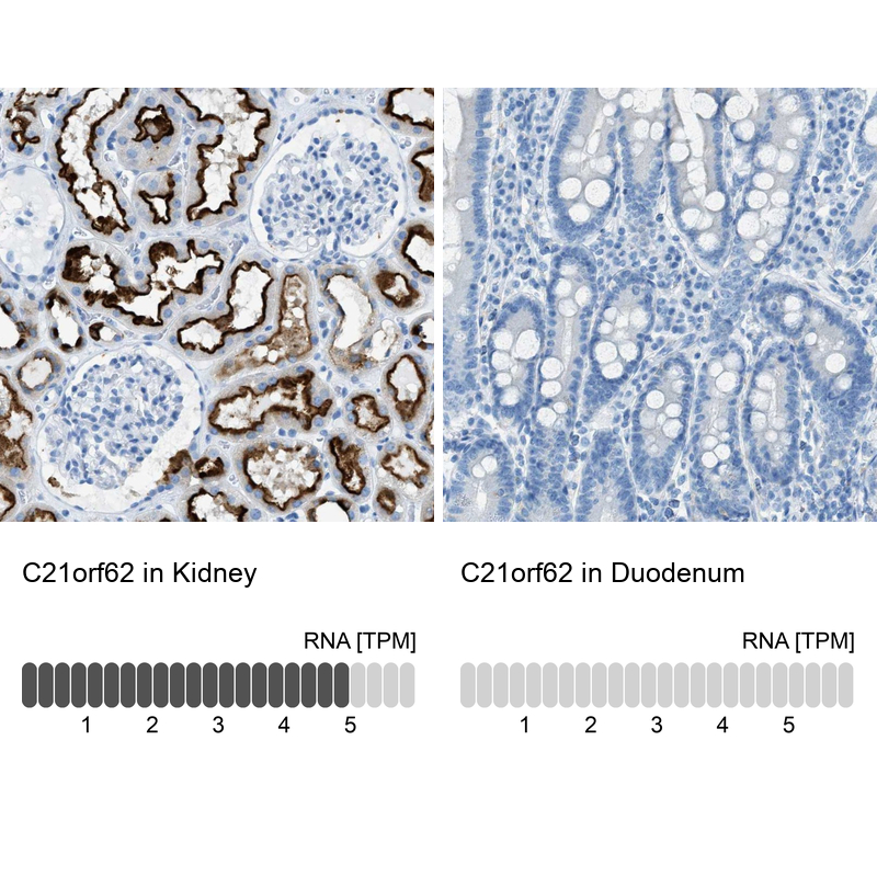 Immunohistochemistry analysis in human kidney and duodenum tissues using Anti-C21orf62 antibody. Corresponding C21orf62 RNA-seq data are presented for the same tissues.