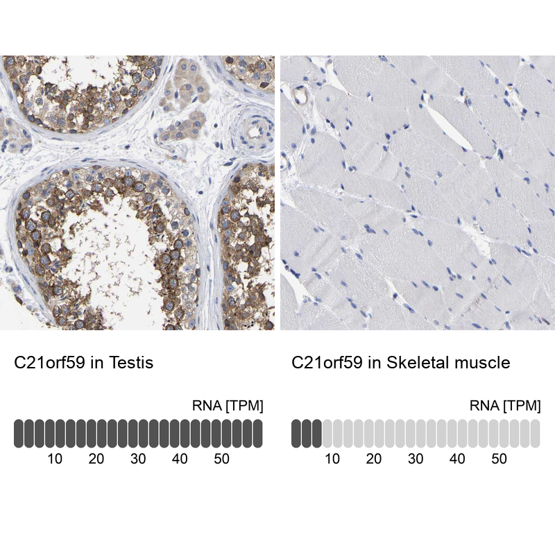 Immunohistochemistry analysis in human testis and skeletal muscle tissues using Anti-C21orf59 antibody. Corresponding C21orf59 RNA-seq data are presented for the same tissues.