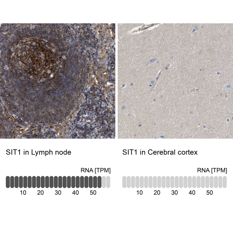 Immunohistochemistry analysis in human lymph node and cerebral cortex tissues using Anti-SIT1 antibody. Corresponding SIT1 RNA-seq data are presented for the same tissues.
