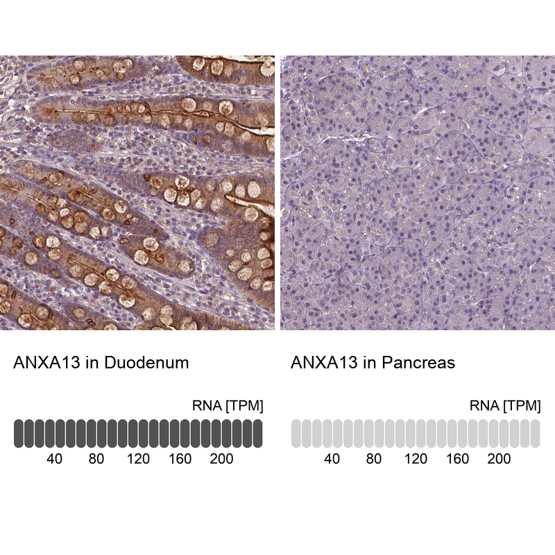 Immunohistochemistry analysis in human duodenum and pancreas tissues using Anti-ANXA13 antibody. Corresponding ANXA13 RNA-seq data are presented for the same tissues.