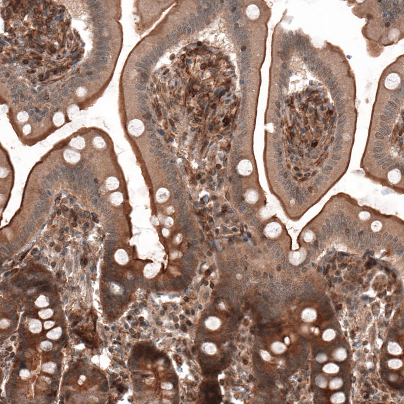 Immunohistochemical staining of human duodenum shows strong membranous positivity in glandular cells.