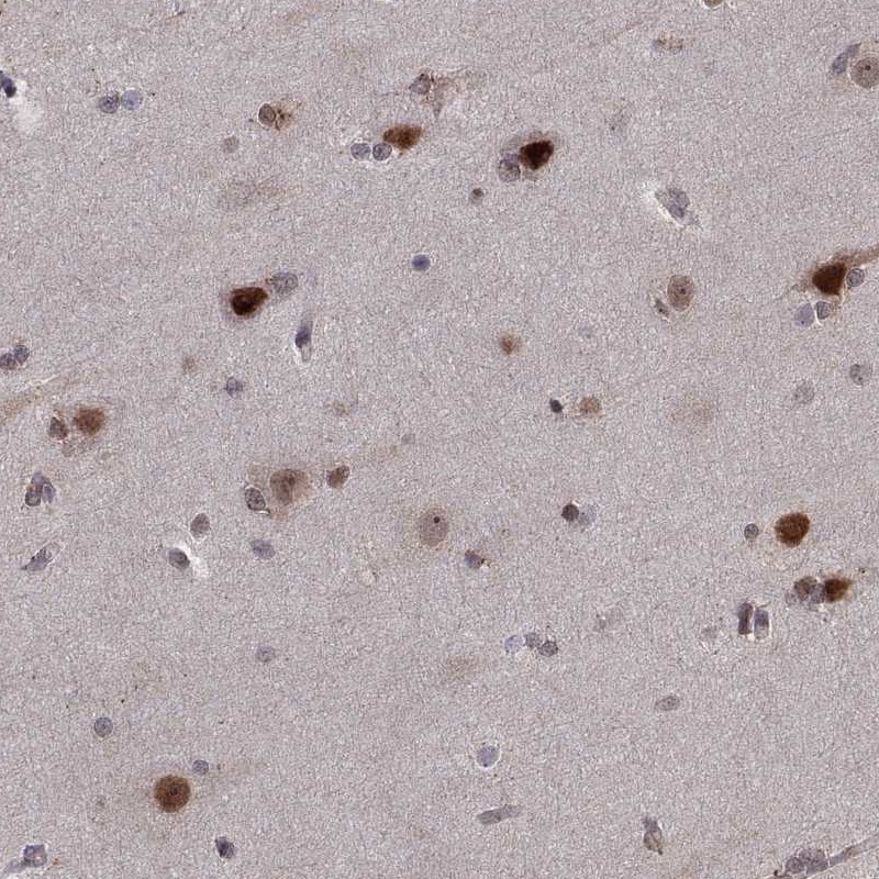 Immunohistochemical staining of human hippocampus shows strong nuclear positivity in neuronal cells.